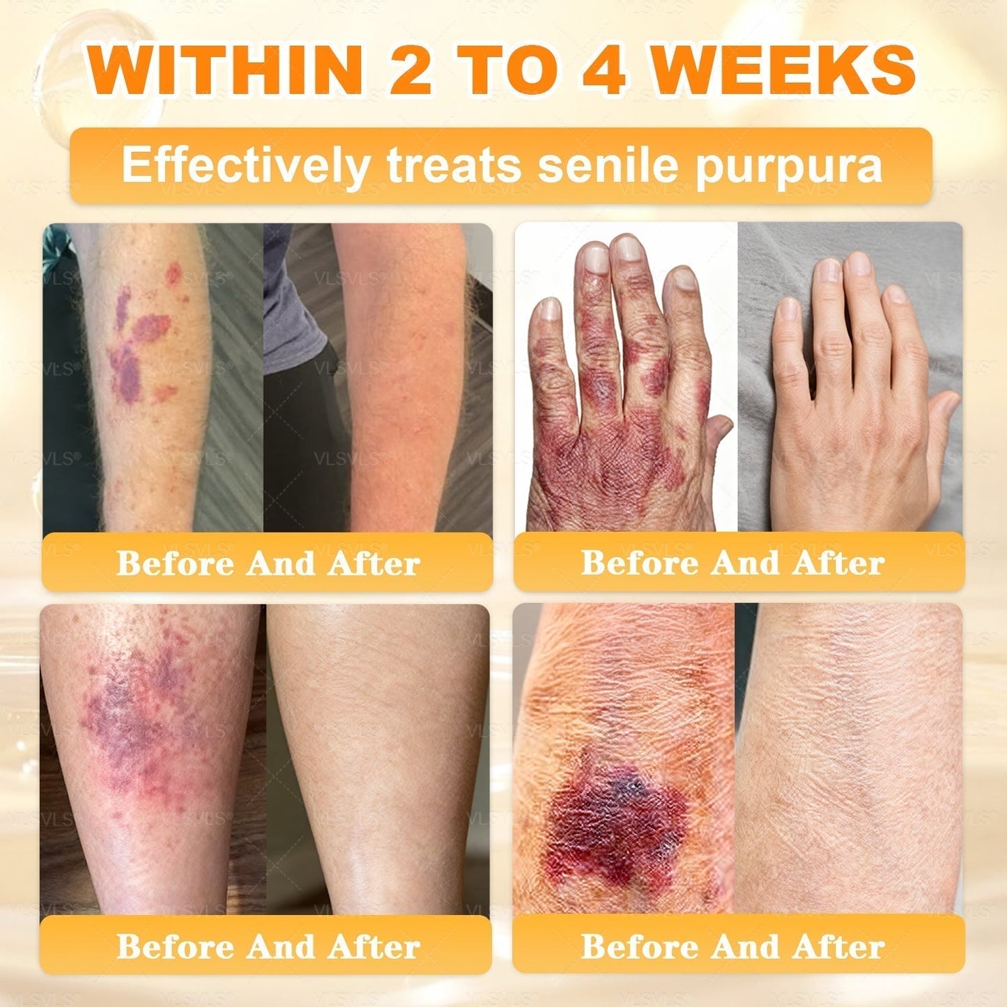 💕 LAST DAY 80% OFF💕 Vitalisys® Bee Venom Skin Restoration Cream