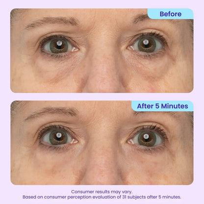 Final 3 Hours: 40%OFF 💎 Instant Lift Eye Gel for Puffiness, Bags & Dark Circles