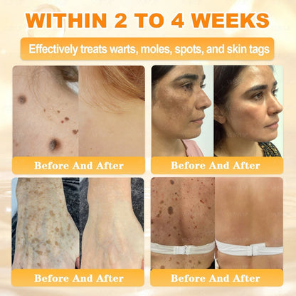 💕 LAST DAY 80% OFF💕 Vitalisys® Bee Venom Skin Restoration Cream