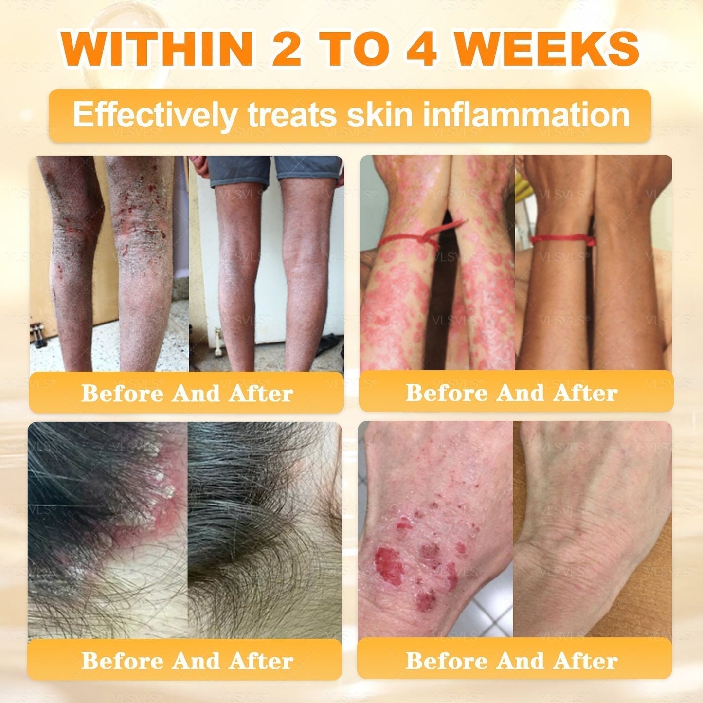 💕 LAST DAY 80% OFF💕 Vitalisys® Bee Venom Skin Restoration Cream