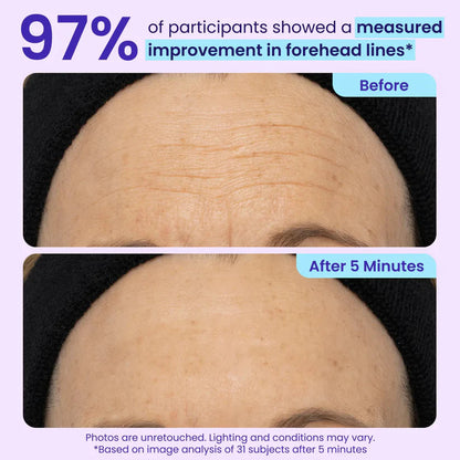 Final 3 Hours: 40%OFF 💎 Instant Lift Eye Gel for Puffiness, Bags & Dark Circles