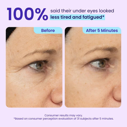 Final 3 Hours: 40%OFF 💎 Instant Lift Eye Gel for Puffiness, Bags & Dark Circles